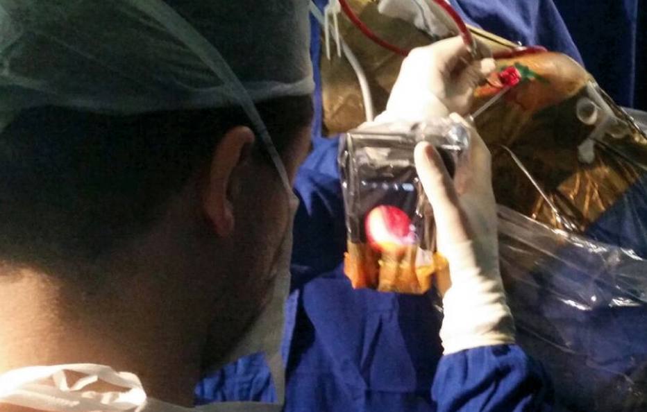 Neurocirurgião Maurício Mandel realizando procedimento com ajuda do smartphone. Foto Reprodução